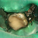 concept endodontique
