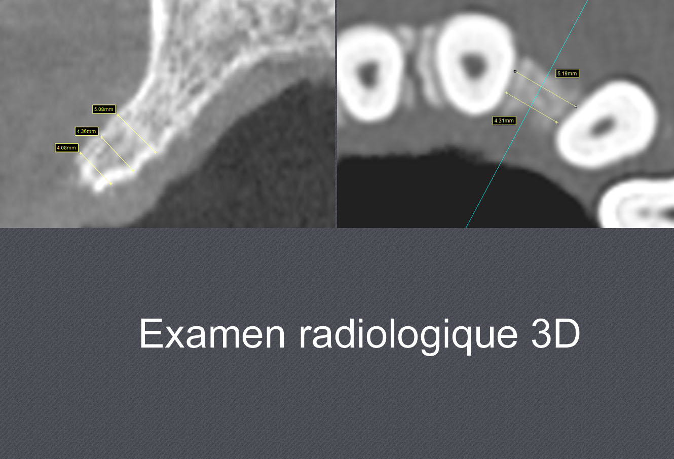 radiologie 3D